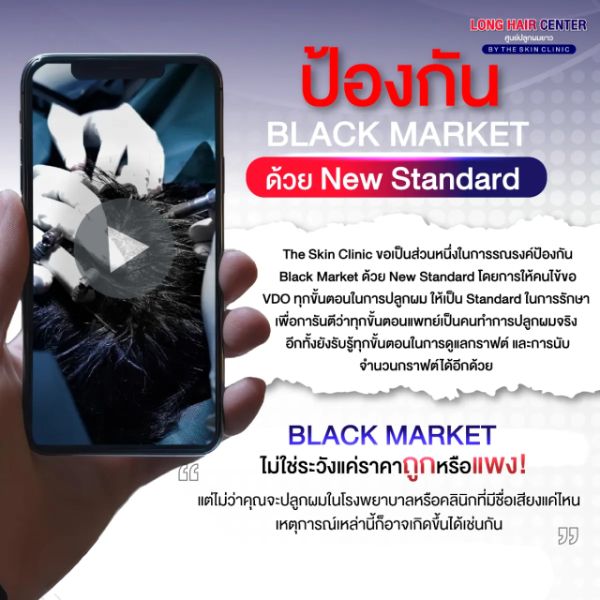 ปลูกผมถาวรแบบโปร่งใส พร้อมถ่ายวิดีโอให้คนไข้ทุกขั้นตอน